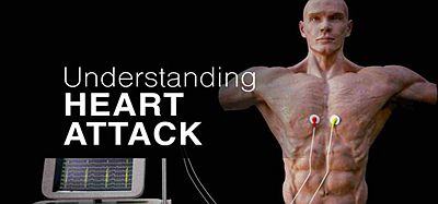 Meta Quest 游戏《了解心脏病》Understanding Heart Attack